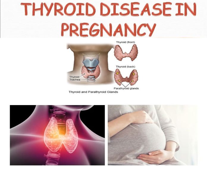 Thyroid problems in pregnancy